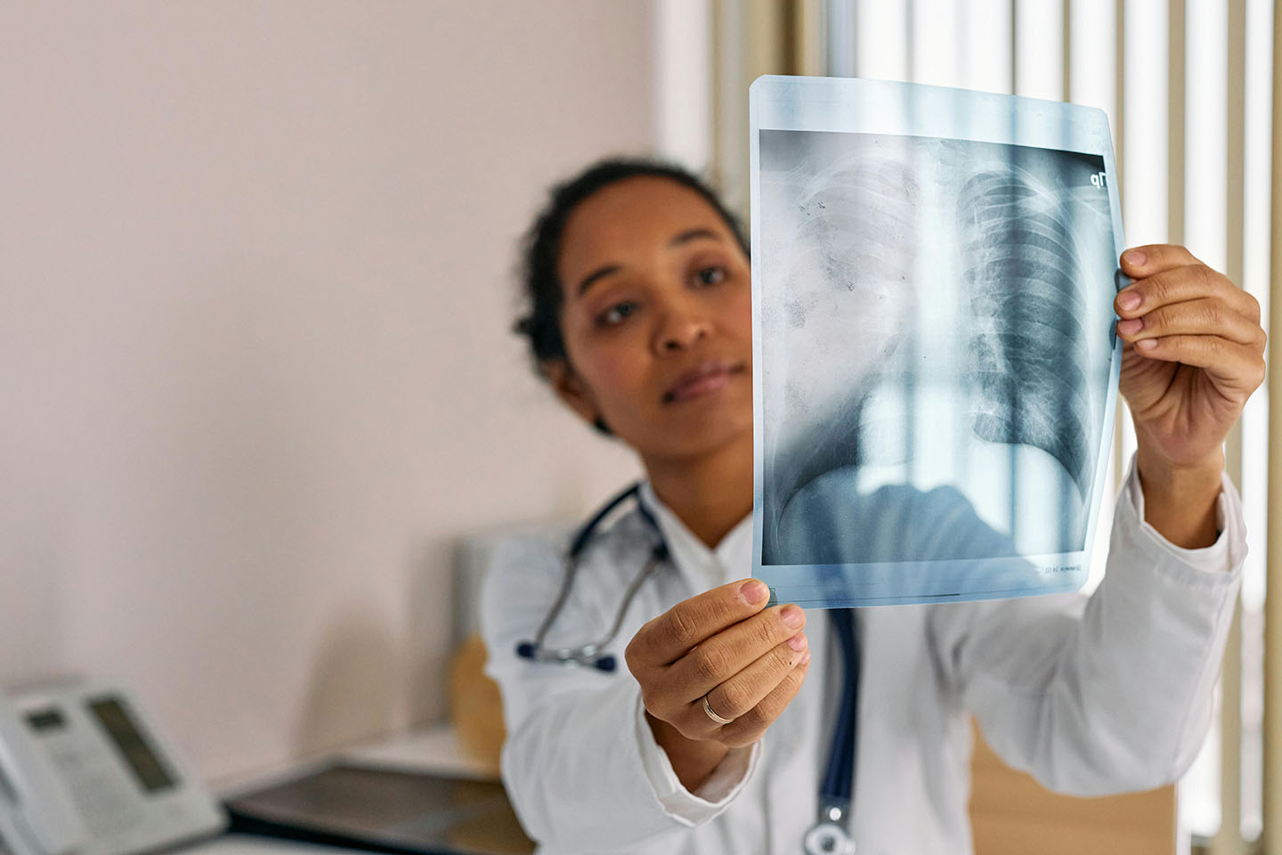 Doctor viewing an x-ray slide of someone's lungs